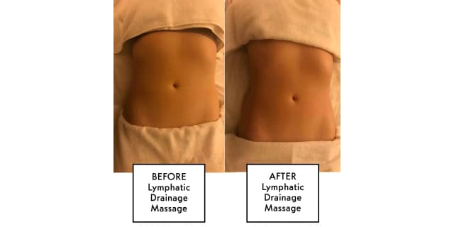 Lymphatic Drainage Massage 30-Minute Session (5 Pack)