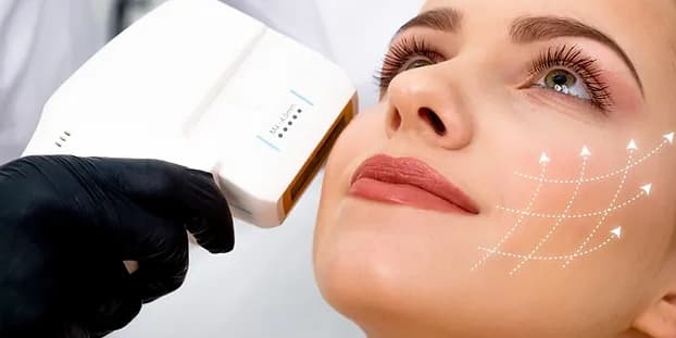 One HIFU Treatment on Under Eyes and Forehead