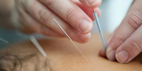 Comprehensive Acupuncture Evaluation and Initial Treatment