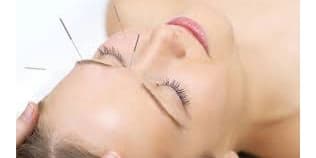 One Cosmetic Acupuncture Session with Facial, Massage & Meditation