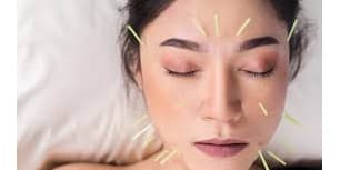 Three Cosmetic Acupuncture Sessions with Facial, Massage & Meditation