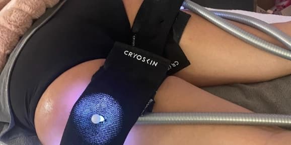Cryotherapy Revolution