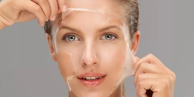 One Facial Chemical Peel Treatment