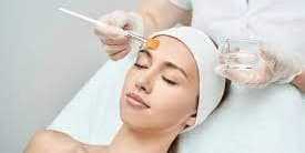 Three Facial Chemical Peels Treatments