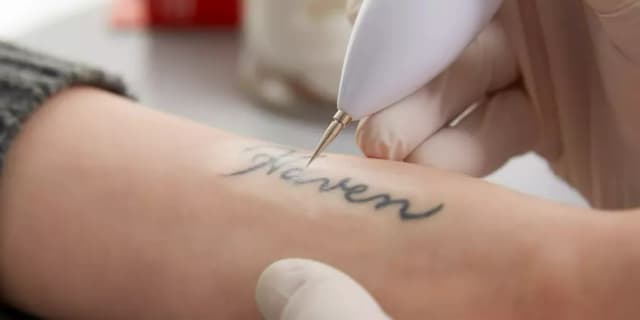 Three Laser Tattoo Removal Sessions for up to 5 square inches
