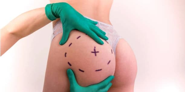 Two 20-Minute Non-Invasive Therma-Lift Butt Lifts