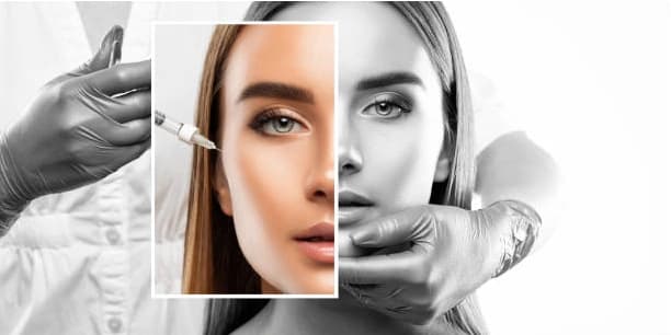 Screw Threads into Lip Border - Four Threads