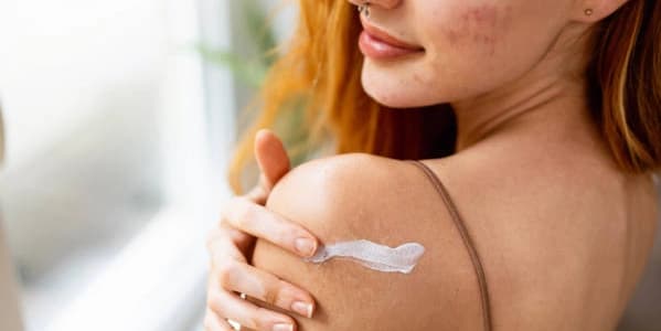 Five Skin Tag Removal Treatments