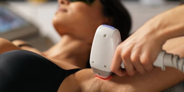 Three Laser Hair-Removal Sessions on One Small Area (Touchup)