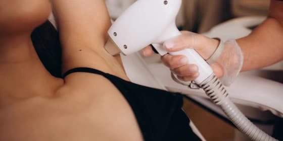 Six Laser Hair-Removal Sessions on a Small Area