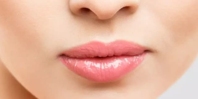 One Syringe of Juvederm Voluma, Ultra or Volbella