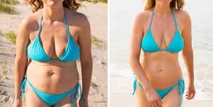 Methionine, Inositol & Choline (MIC) Weight Loss Injections