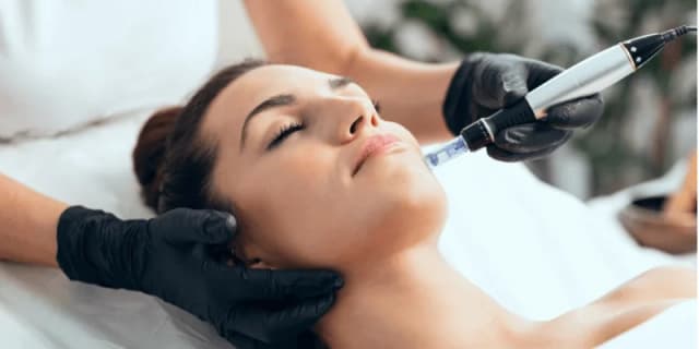 Botox Microneedling Treatment - A Premium & Rare Beauty Service