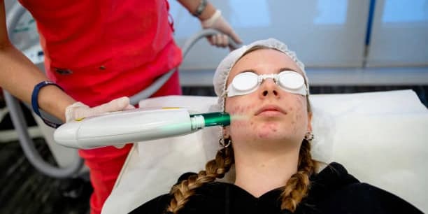 One Acne Treatment Session cleanse, exfoliation, extractions, light peel, sulfur mask for acne and green light therapy