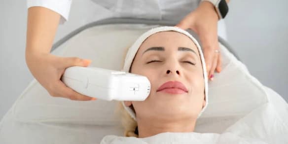 Two ThermLift Skin-Tightening Facelifts