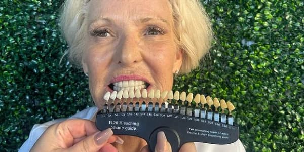 One Regular Strength Teeth Whitening Session