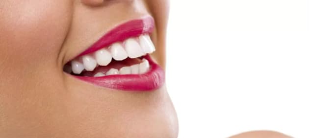 Three 30-Minute Basic Teeth-Whitening Sessions