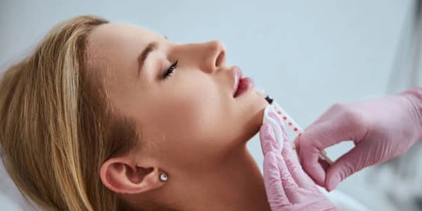 One Vial of Radiesse Dermal Filler