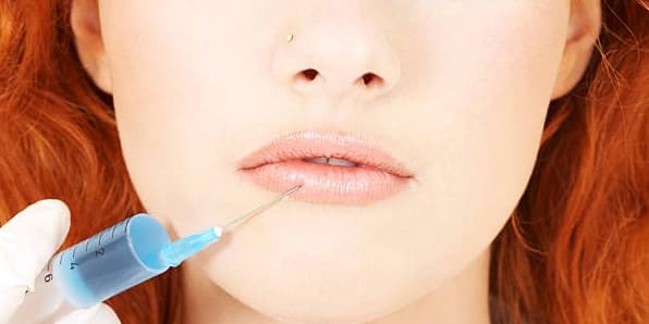 One Syringe of Revanesse Kiss