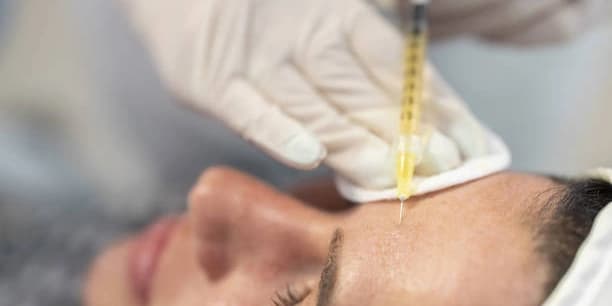 PRP With Microneedling Any One Area One Treatment