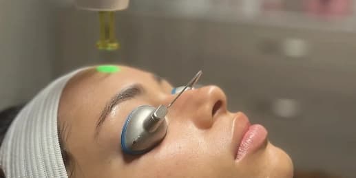 Three 30 Minute Laser Facials