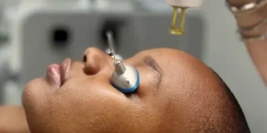 One 30 Minutes Laser Facial