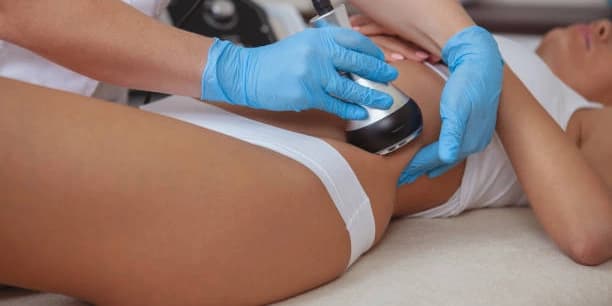 One 60-Minute Session of Ultrasonic Lipo Cavitation Treatment