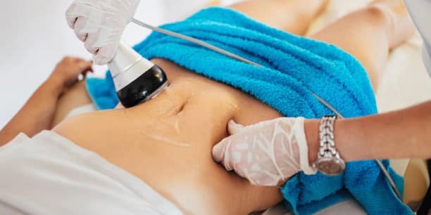 One 60-Minute Session of Ultrasonic Cavitation & Radiofrequency Treatment