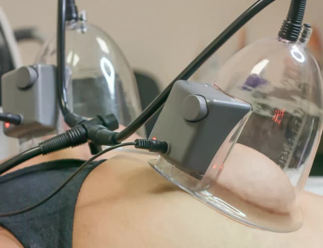 One Vacuum BBL Package of 4 Sessions - Valid for One Month