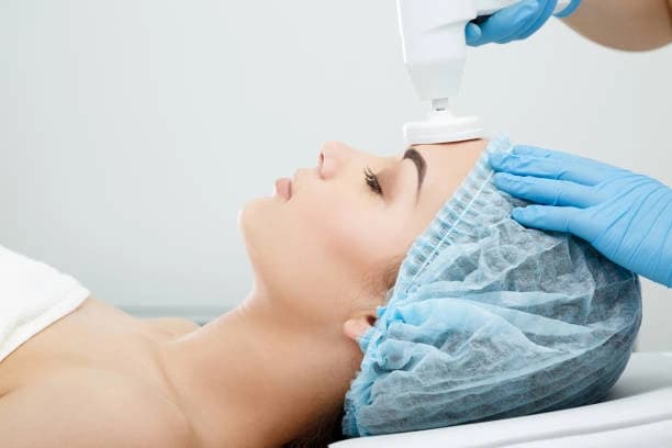 One Ultra Lift Face Lift Session