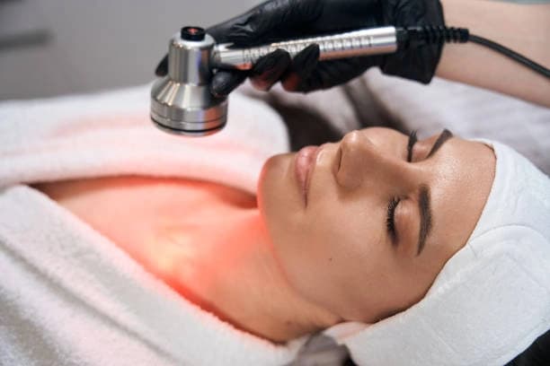 One Micro-Needling Treatment with red light therapy and Dermaplaning