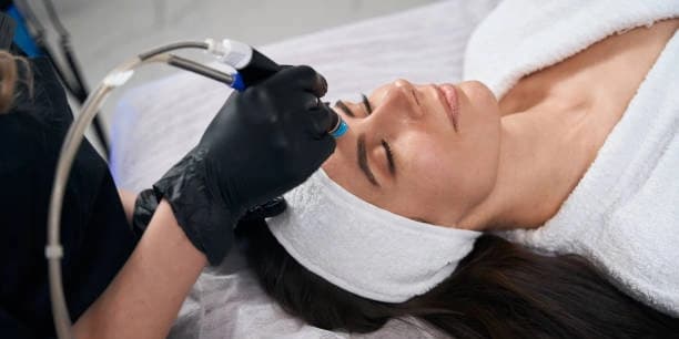 Dermaplane & Micro-needling Treatment