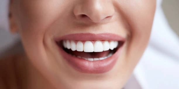 Two Teeth Whitening Treatments