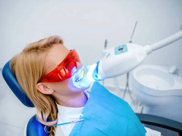 Single Treatment of Teeth Whitening
