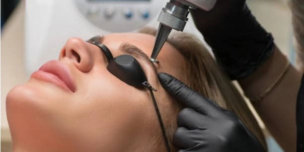 One Skin Tag, Cherry Angioma, Sun Spot, Age Spot, or Milia Laser Removal