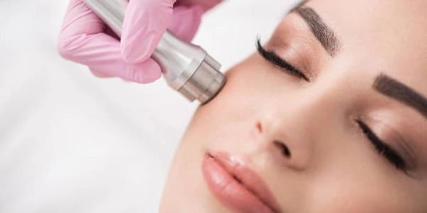 One Diamond Microdermabrasion Treatment