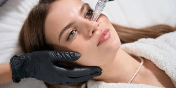 One Microneedling Session with Hyaluronic acid serum