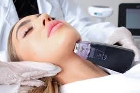 Face - Radio Frequency Microneedling