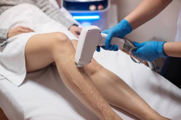 Laser Hair Removal Full Legs and Under Arms