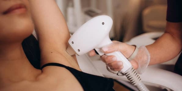 Buy 2 Get 1 Free - Underarms Laser Hair Removal Treatment