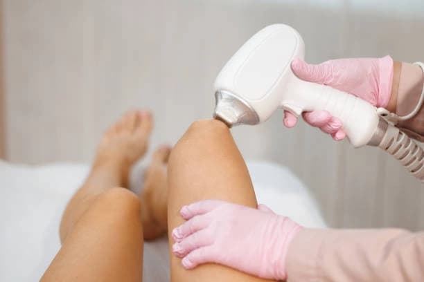 Buy 2 Get 1 Free - Full Leg (Includes feet & toes) Laser Hair Removal Treatment