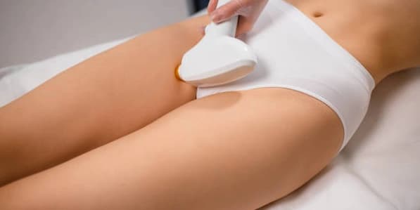 Buy 2 Get 1 Free - Brazilian Laser Hair Removal Treatment