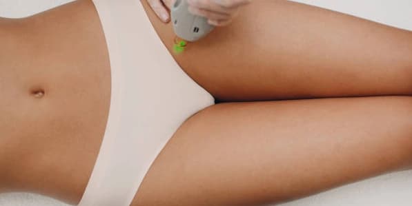 Buy 2 Get 1 Free - Bikini Laser Hair Removal Treatment