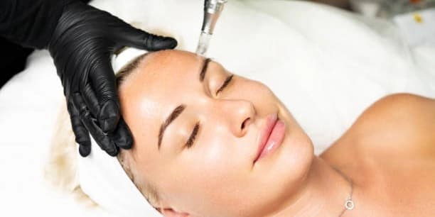 Two PRP Facials with Microneedling