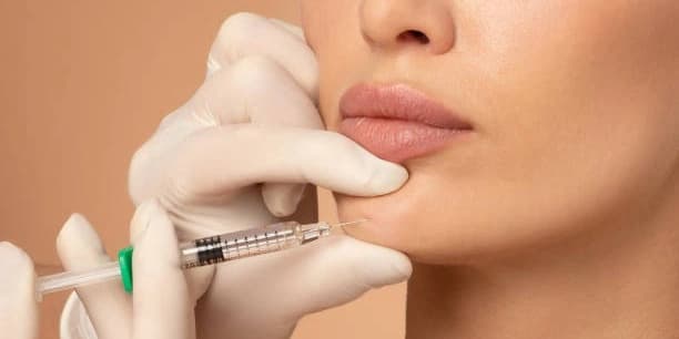 One Syringe of Juvederm Voluma XC