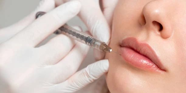 40 Units of Xeomin or Jeuveau