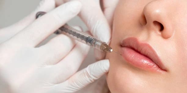 40 Units of Xeomin or Jeuveau