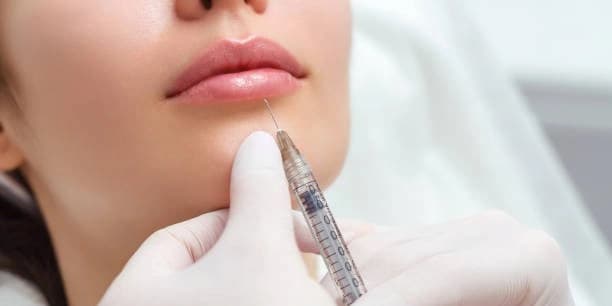 One Syringe of Juvederm Ultra Plus XC