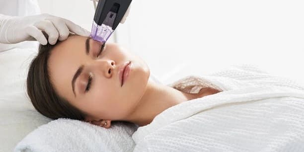 One RF Microneedling Morpheus 8 Treatment for Full Face