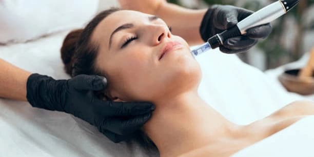 One PRP Facial with Microneedling